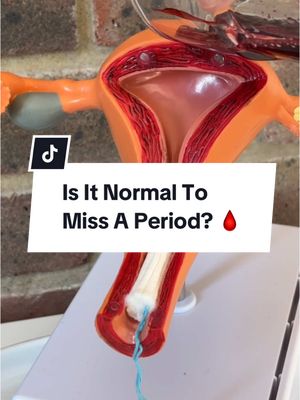 A cover image featuring a model of the female reproductive system. A banner that has the text “Is It Normal To Miss A Period?” is overlaid across the middle of the image. There is a stylized blood droplet emoji next to the question mark. The background appears to be a white surface