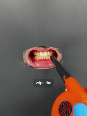 A close-up shot of a mouth held open with a dental retractor, exposing the teeth. The teeth have a yellow hue. A black and orange tool is positioned near the teeth.