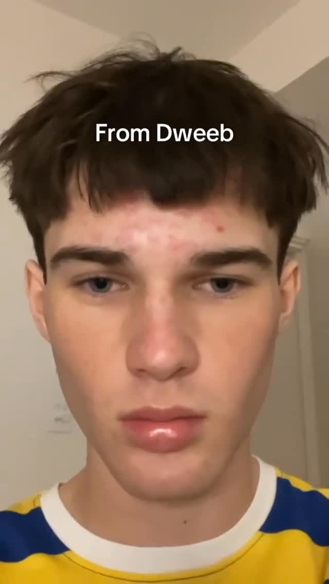 A close-up shot of a young man's face. He has short, dark brown hair and a fair complexion. The overlay text reads 'From Dweeb'. He is wearing a yellow and blue shirt. His eyes are blue, and there are a few blemishes on his forehead. The background is a blurry, off-white wall.
