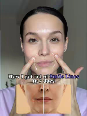 The cover image shows a woman with fair skin, dark hair, and a neutral expression. She is touching her face near her mouth with her fingers, and overlaid on the image are dotted lines. The background is blurred, and below her face is an image of someone's face before and after the same line treatment. Text overlayed on the top is "How I got rid of Smile Lines in 7 days". The image uses a soft color palette that enhances the focus on the subject and the message of the before-and-after comparison.