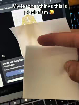 The cover image shows a laptop screen displaying the Google search results with a close-up of a yellow human skeleton. A piece of paper is held in front of the screen, partially obscuring the display. The scene is set from a first-person perspective, with a hand holding the paper over the laptop.