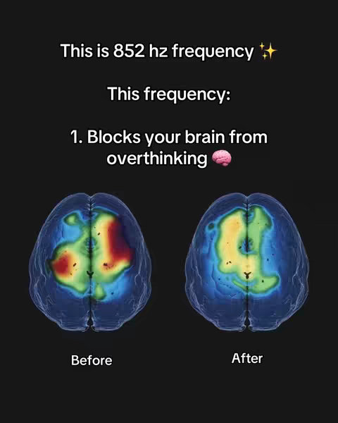 The image is a graphic comparing brain scans before and after exposure to 852 Hz frequency. Above the brain scans, text reads, 'This is 852 hz frequency'. Below the text is 'This Frequency' and a bulleted list '1. Blocks your brain from overthinking'. The 'before' scan shows a brain with red and yellow hues, while the 'after' shows green and yellow, suggesting a positive change. The background is black. The font choices are Sans-serif.