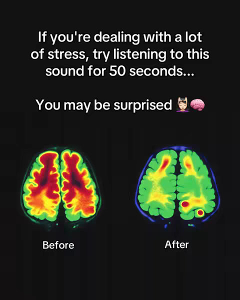The cover image is a dark background with two images of brain scans side by side labeled "Before" and "After". Above the scans is white text, that serves as the hook. There are no visible people in the image.