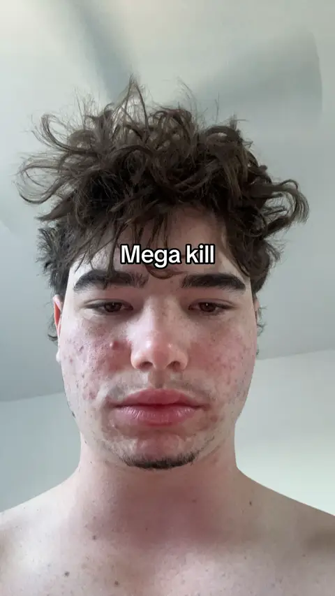 A close-up of a young man's face. The background is a plain off-white. The man has messy brown hair, and his skin shows some redness and blemishes. The text 'Mega kill' is superimposed at the top center of the image.