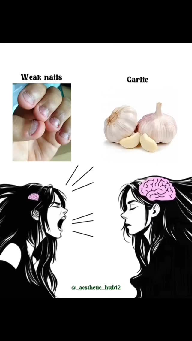 The cover image is a split-screen graphic with two sections above two more illustrated panels. The top left shows an image of damaged nails. The top right shows two garlic bulbs and cloves. The bottom panels depict an illustrated style with a woman on either side of the image. The woman on the left is shouting and the woman on the right is deep in thought. The background is plain white. The watermark ‘@_aesthetic_hub12’ is located at the bottom center.