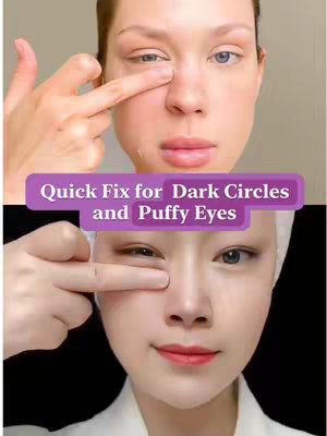 The cover image is split into two halves, showcasing a before-and-after view of a facial treatment. The top half features a person pointing at their under-eye area, with visible dark circles and slightly puffy eyes. The lower half replicates the pose but shows a person with a smoother, more refreshed appearance around their eyes. A purple rectangle with white text overlays the central area of the picture. The background appears to be a simple, neutral color.