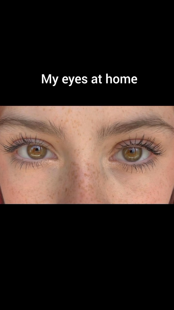Close-up shot of a person's eyes, with the text 'My eyes at home' overlaid. The eyes have light brown irises and long, dark eyelashes. The skin around the eyes has freckles. The background is solid black.
