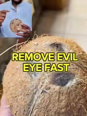 The image is a close-up shot featuring a large coconut in the foreground. The coconut is brown and partially covered in the fibrous husk. In the background, there's a person holding another, smaller coconut. The person is shown from the chest up, wearing a light-colored shirt. Above the coconut, text overlays in a bright yellow box and says 'REMOVE EVIL EYE FAST'. The overall composition has a casual, informational tone.