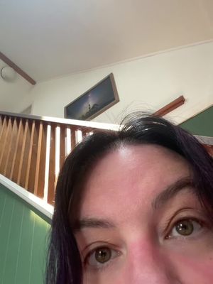 Close-up image focusing on a person's eyes, with the top of their hair and forehead visible. The eyes are brown, and the skin appears to have a slight flush. The background is blurred, suggesting an indoor setting, with a staircase and artwork just visible.