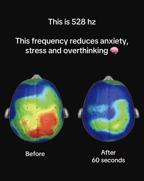 The image shows two diagrams of a human head from a top-down view, depicting brain activity visualizations. Each diagram is a colorful representation, with the colors likely signifying different levels of activity. Text overlays read "This is 528 hz" and "This frequency reduces anxiety, stress and overthinking."