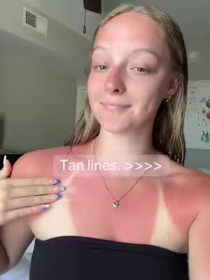 A woman with fair skin and blonde hair is shown from the chest up. She has a noticeable sunburn on her shoulders and upper chest, with clear tan lines. A text overlay is displayed. She is slightly smiling, indicating a positive reaction possibly.