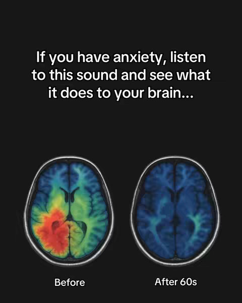 The cover image is a split screen on a black background. On the left, an axial view of a brain scan shows a brain with areas of red and yellow, overlaid on a blue-green field. Beneath it is the word "Before." On the right, another brain scan shows a blue field; the word "After 60s" is written below it. The images suggest changes in brain activity.