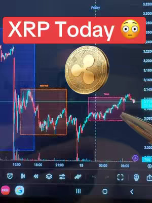 The cover image showcases a chart of XRP's price fluctuations, with areas highlighted and an XRP coin graphic. Below the chart, a phone layout gives it a screen-recording feeling. Overlay text announces "XRP Today" with an emoji representing surprise.