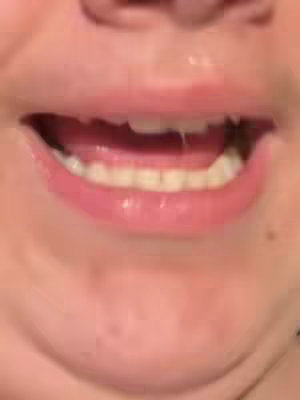 A close-up shot of a person's open mouth, displaying the lower teeth and tongue. The lips are glossy and pink, suggesting the use of lip gloss or lipstick. The skin around the mouth is a natural tone. The overall image focuses on the mouth as the central element.