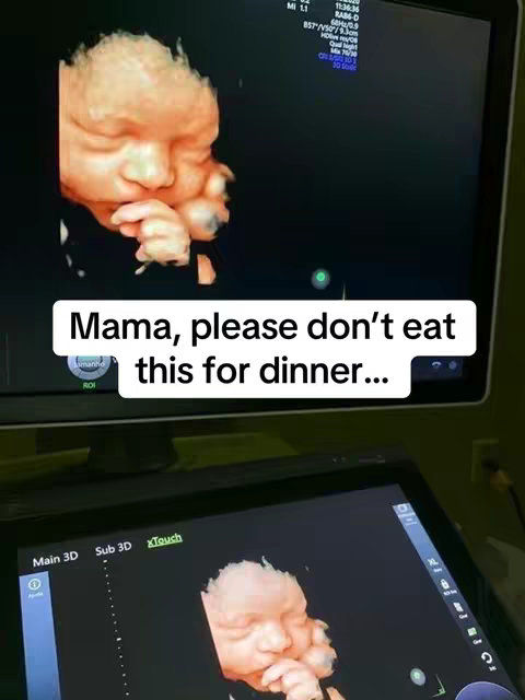The image shows an ultrasound scan with a developing fetus. Overlayed text reads 'Mama, please don't eat this for dinner...' against a dark background with the ultrasound machine clearly visible.