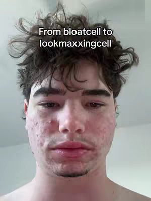 A selfie-style shot featuring a close-up of a young man's face. The man has short, tousled dark hair and appears to be looking directly at the camera. His face shows visible skin texture, with some redness and acne. The text overlay, 'From bloatcell to lookmaxxingcell,' is positioned above his head against a blurred white background.