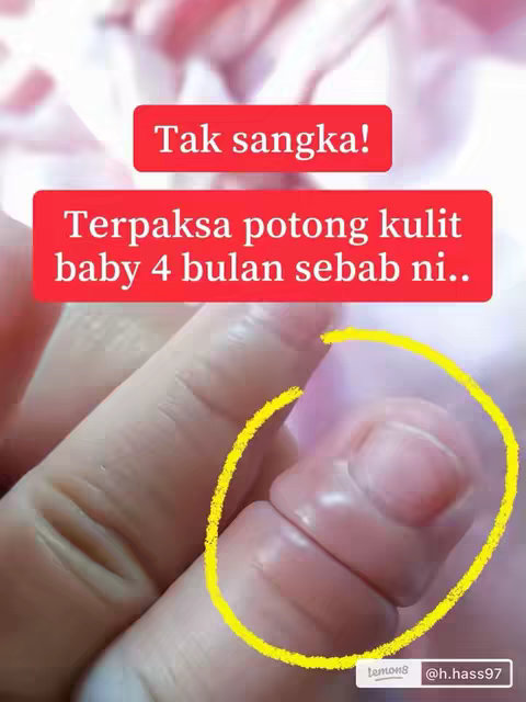 The image shows an extreme close-up of a baby's finger, with a finger being circled in yellow; the text overlays in read blocks, and there's a light, blurred background.