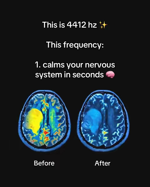 The image is a graphical representation, mainly on a black background. The top section features the text "This is 4412 hz" followed by a golden star. Below this, the text "This frequency:" is followed by a numbered list: "1. calms your nervous system in seconds" and an emoji of a brain. Two brain scan images are presented side-by-side below the text, one labeled "Before", showing a yellow spot, and the other labeled "After", presenting a blue spot, presumably depicting the effect.