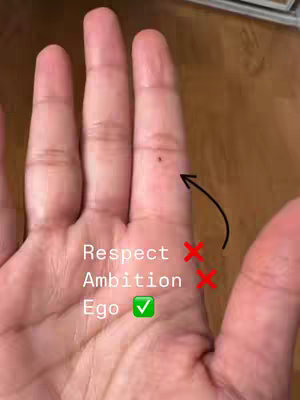 The image shows a close-up of a hand with the palm facing upwards. The hand is slightly open, and the skin appears fair-toned. A small dark mole is visible on the middle finger. Text overlays on the image label aspects of the person.