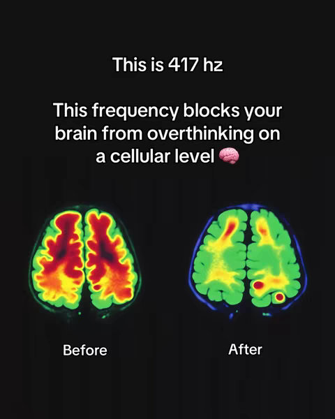 The cover image shows a black background featuring two brain scans side by side. The one on the left is labeled "Before" and shows a brain scan in shades of red, yellow, and green, with high activity. The right side is labeled "After" and depicts a brain scan in green with some yellow and a small red spot, indicating less activity after the frequency. The overall layout is clean and informative, using color contrast to emphasize the before-and-after state of the brain.