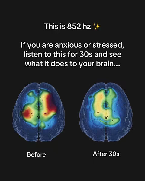 The cover image is a dark background with white text overlaying two images of a human brain. The text reads, "This is 852 hz," followed by a prompt to listen for 30 seconds. The brain images are side-by-side, with a 'Before' and 'After 30s' caption. The brain scans display colorful heatmaps.
