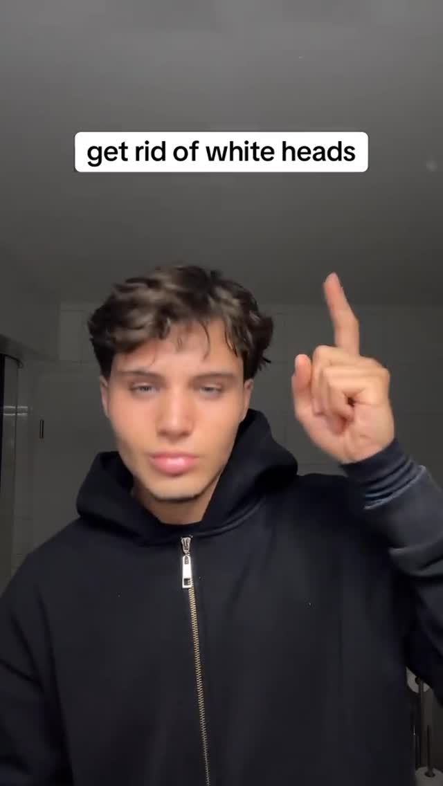 A young man with dark hair is centered in the frame with a black hoodie, and is pointing up with his right index finger. A text overlay reads 'get rid of white heads'.