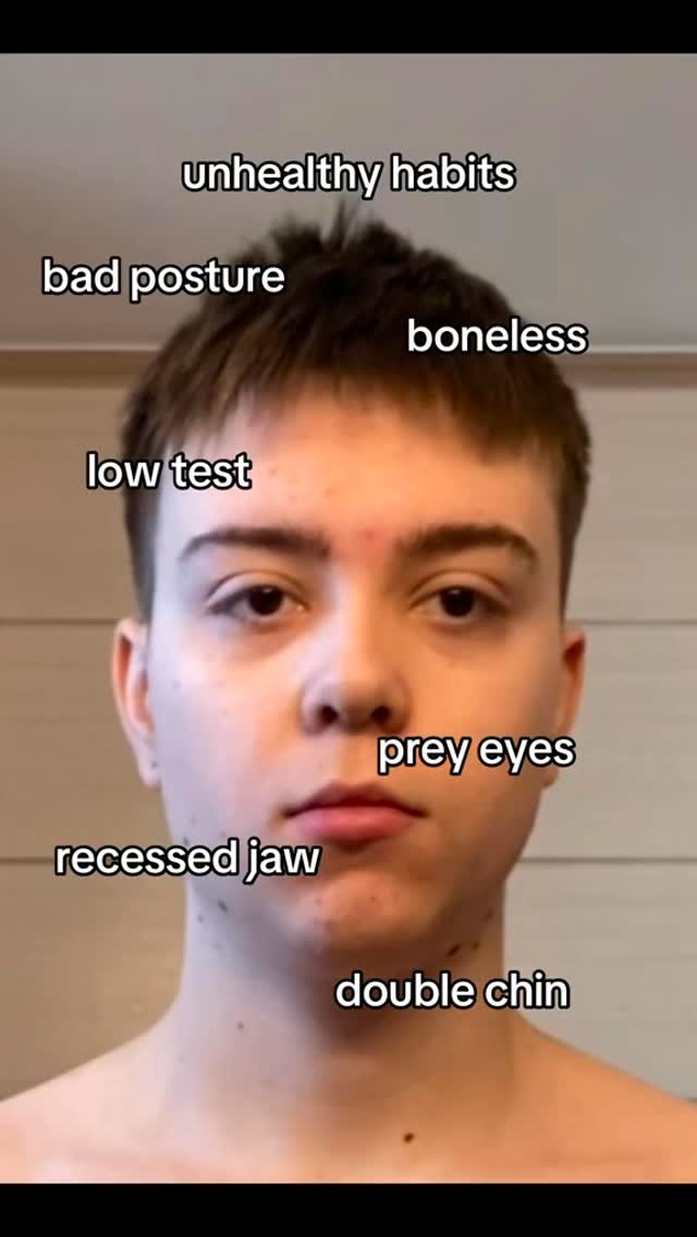 The image is a selfie of a young man, likely indoors. He's facing the camera directly with a neutral expression. The lighting is somewhat flat, and the background is a plain wall. Overlaid on the image are seven white rectangular text labels describing different features. These are arranged around the man’s face, pointing out traits like "unhealthy habits," "bad posture," "low test," "recessed jaw," and more. The overall design is straightforward, with black text against the man's skin tone and the white text boxes.
