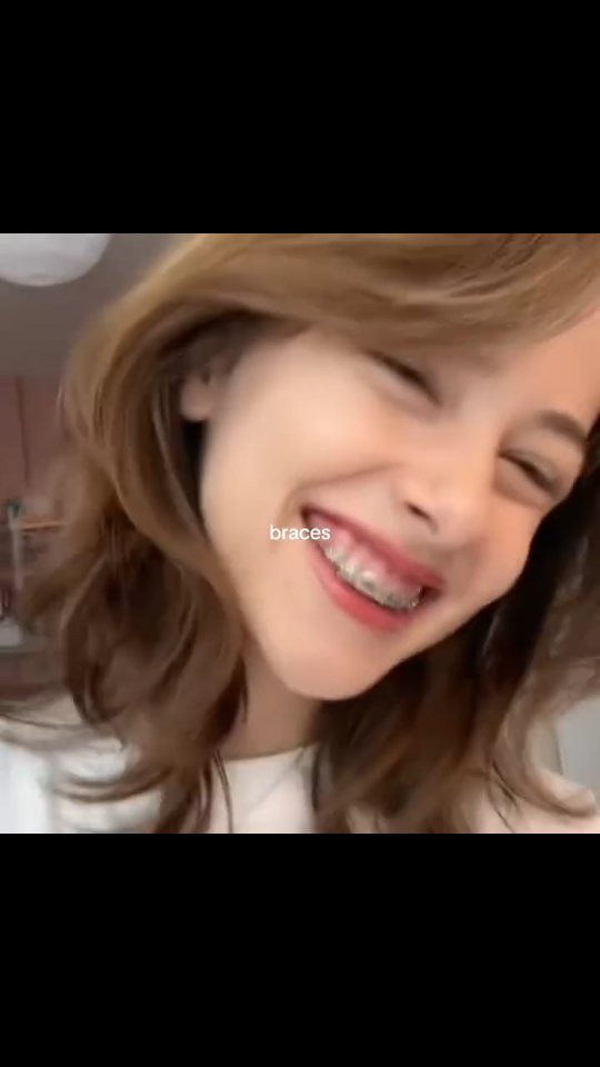 A close-up shot of a young woman smiling. Her teeth have braces, and there's text overlayed: 'braces'.