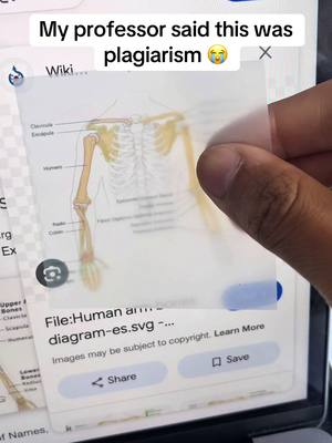 A hand holds a transparent sheet over a laptop screen displaying a close-up of a human arm diagram from what appears to be a search engine results page. The overlay has text stating that the content is plagiarism. The color palette consists of blues, whites, bone color, and shades of brown.
