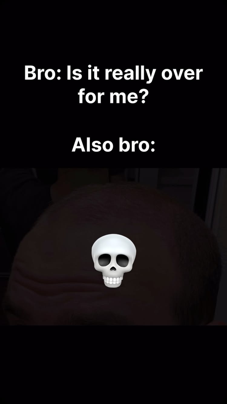 The image is set against a stark black background. In the foreground, there is a view of the back of a person's head, their hair thinning significantly. Overlaid at the base of where the hair is thinning, is a white skull emoji, staring at the viewer. Above the head, is text that reads "Bro: Is it really over for me?" and at the bottom of the text is "Also bro: ". The text is white and in a simple sans-serif font.