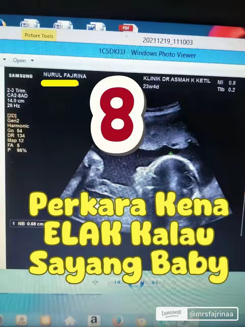 The image shows a computer screen displaying an ultrasound scan of a fetus. Overlayed on the image is a large, red number "8" inside a white circle. Below, the text "PERKARA KENA ELAK KALAU SAYANG BABY" which translates to "Things to avoid if you love your baby" in yellow, bubbly font appears.