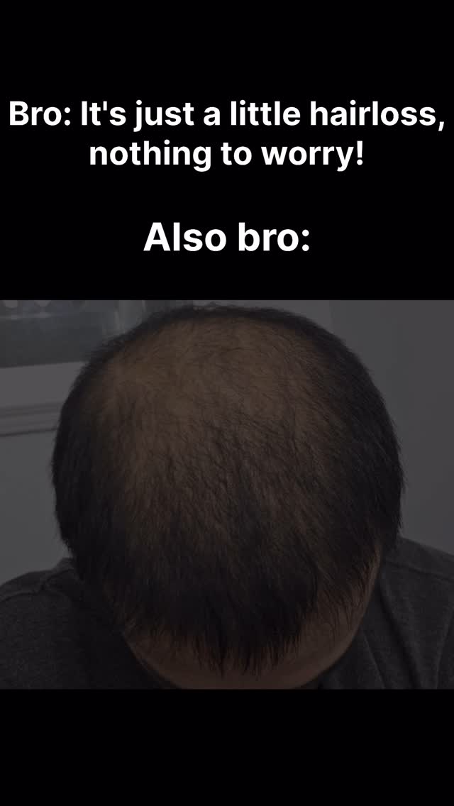 The image is a split screen: the top shows text on a black background. The bottom portion of the image shows the back of a man's head with thinning hair.