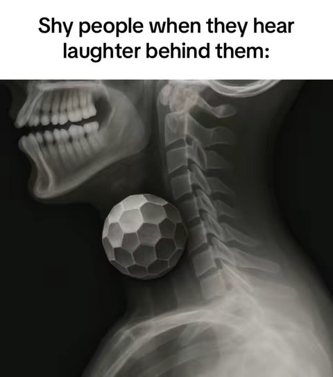 An x-ray image of a human head and neck. The text overlay at the top reads 'Shy people when they hear laughter behind them:' The image is primarily gray, with the skeletal structures appearing in sharp contrast. A pixelated, spherical object is superimposed over the throat area.