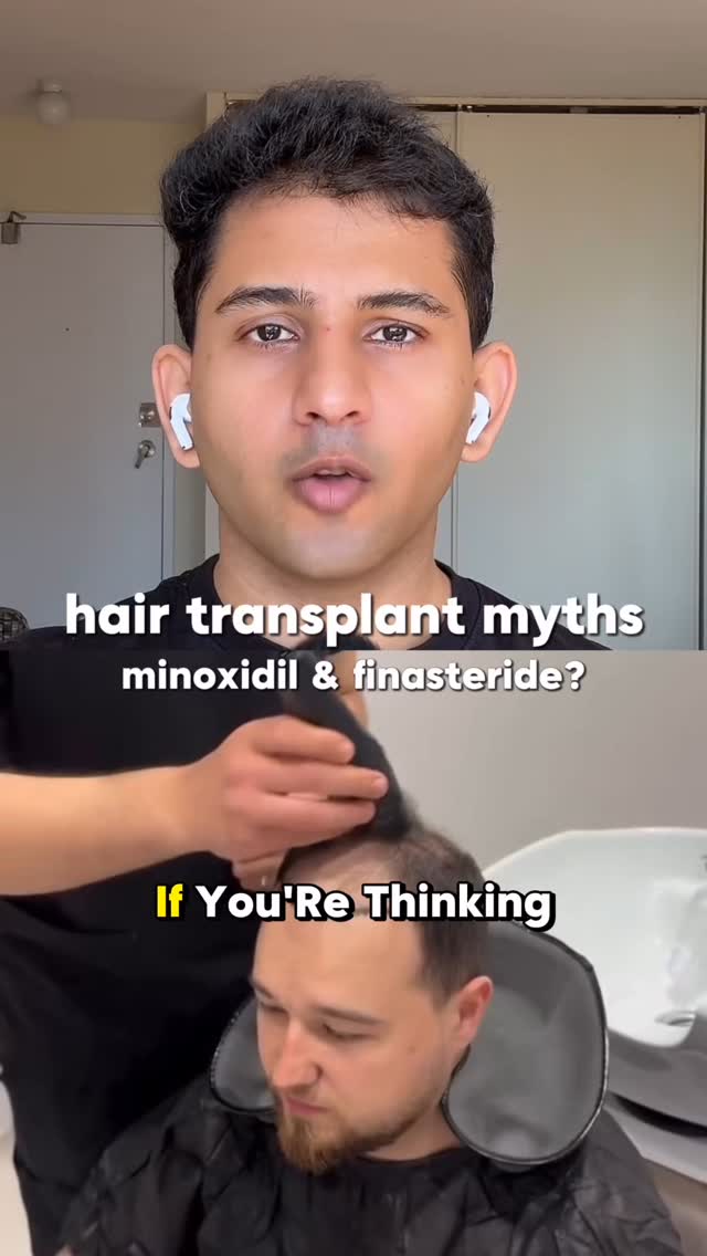 The image shows a split screen. The top half features a light-skinned man in a black shirt with white earbuds, looking directly at the camera. Text overlays his upper body with the words 'hair transplant myths minoxidil & finasteride?' The bottom half shows a close-up of a man having his hair examined, and text overlays with the words, 'If You're Thinking'.