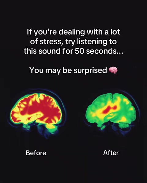 The image shows two brain scans side-by-side. The left scan, labeled 'Before,' shows a brain with areas of red and yellow, suggesting high activity or stress. The right scan, labeled 'After,' shows more green areas, indicating a shift towards reduced activity or calm. Above the scans, text explains the image as if it shows the effect of listening to a sound for stress relief.