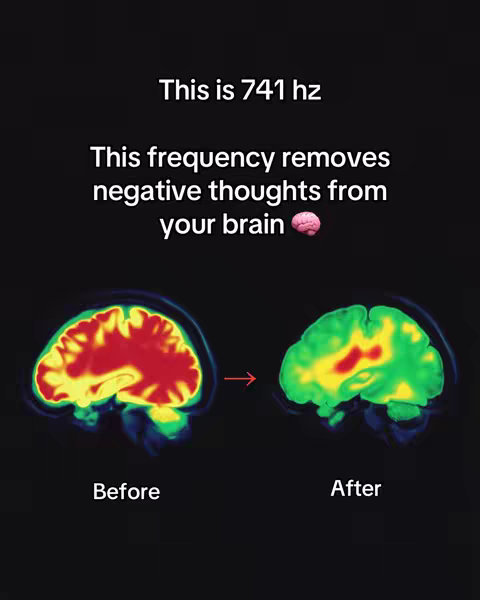 The image is a visual diagram illustrating the impact of a 741hz frequency on the brain. It presents two side-by-side images of a brain in cross-section. The 'Before' image displays vibrant red and yellow hues, suggesting high activity, while the 'After' image shows a shift to cooler green and yellow tones, implying a reduction in that activity. The layout features the title 'This is 741 hz' at the top, with text explaining the frequency's effect below. The words 'Before' and 'After' are placed under the respective brain images, and an arrow indicates the transformation from the 'Before' to the 'After' state. The background of the image is black, making the colorful brain illustrations stand out clearly.