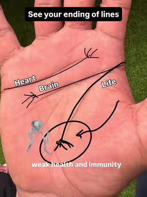 A close-up of a hand with the palm facing up, marked with black lines and annotations that appear to be an illustration of palmistry. The image has text overlays that label key lines, such as Heart, Brain, and Life. There is an additional illustration of a skeleton with arrows pointing to the hand.