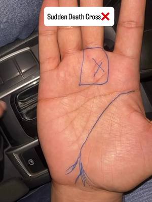 Image shows a close-up of a person's palm, with lines and markings. A blue box and an X are drawn on the palm, along with some blue lines. Text overlay at the top reads 'Sudden Death Cross' with an X.