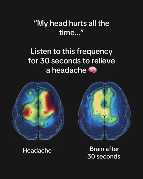 The image is a dark background with text overlay and two brain images side by side. The text says, "My head hurts all the time..." Listen to this frequency for 30 seconds to relieve a headache." The left brain image is a scan with a red and yellow color gradient to indicate a headache, and the right image shows a brain scan with a green and yellow gradient. The text "Headache" is below the first brain image and "Brain after 30 seconds" below the second, next to the brain image.