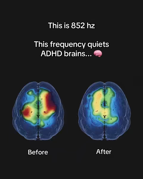The image presents a before-and-after comparison of brain activity, visualized through colorful scans. Above, text reads 'This is 852 hz' and 'This frequency quiets ADHD brains...', accompanied by a brain emoji. The 'Before' scan on the left shows a red and yellow area, while the 'After' scan on the right appears calmer in green and yellow. The background is black.