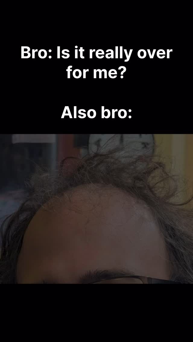 The image features a close-up of a man's forehead, showing a receding hairline. Above, text overlays say: "Bro: Is it really over for me?" and then "Also bro:".