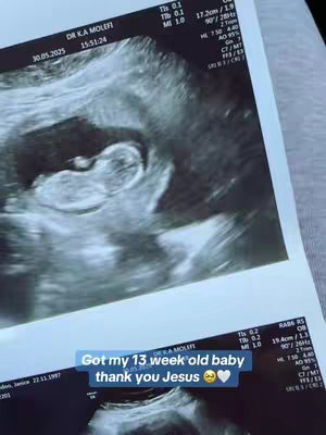 The cover image shows an ultrasound scan with text overlayed. The scan is of a fetus, appearing in shades of gray. The overlaid text is in a bubbly font and reads 'Got my 13 week old baby thank you Jesus', followed by a white heart emoji. Overall, the image is indicative of a pregnancy and a thankful announcement.