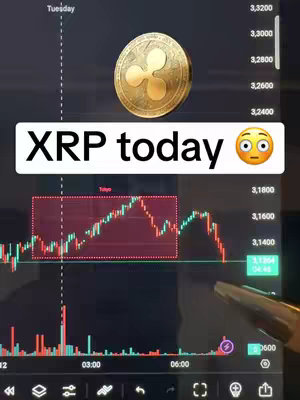 The cover image shows a screenshot of a stock chart for XRP (Ripple), with a gold XRP coin overlaid. The chart displays a declining trend in red over a black background. Prominently, the text 'XRP today 😲' is displayed on a white banner.