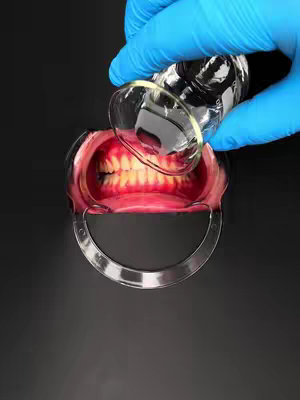 A close-up shot features a dental retractor holding open a mouth, displaying yellowed teeth. A hand wearing a bright blue glove pours a clear liquid from a small, clear bottle over the teeth. The background is solid black, emphasizing the dental setup and the pouring action.