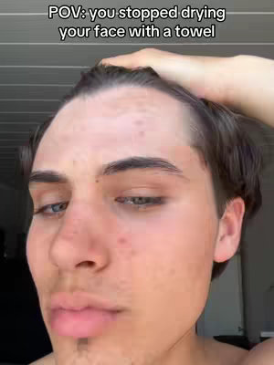 A close-up shot of a young man partially obscured covering his head with his hand. Above the man's head is a text overlay in a white font. The lighting is bright, highlighting the texture of the man's skin. The background is out of focus.