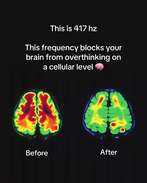 A split image showing brain scans labeled 'Before' and 'After'. Text overlays state 'This is 417 hz' and explain the frequency's effect on overthinking. The 'Before' scan shows high brain activity in red and yellow, while the 'After' scan indicates reduced activity in green.
