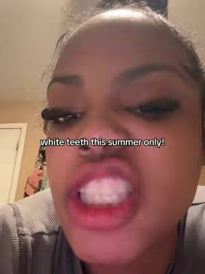 A close-up selfie of a person with their mouth open, showing white teeth. The person has dark hair, is wearing makeup, and has a neutral background.