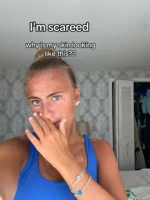 A selfie-style shot of a young woman covering her mouth with her hand. She has blonde hair pulled back, blue eyes, and a concerned expression. The background shows a light-colored wall with a patterned design and a partially visible closet.