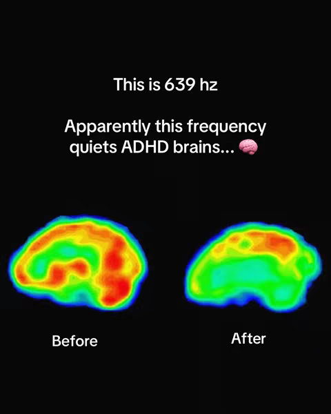 The cover image shows what appears to be medical brain scans on a black background. The top part of the images has overlaid text that provide context for the scan. The brains scans shown are of different colors with the before image showing a lot of red.