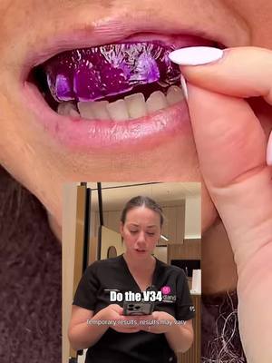 The cover image shows a close up shot of a mouth with the upper teeth covered in a purple substance. A smaller inset image shows a woman holding a phone with a smile. Text overlays 'Do the V34' and additional text.